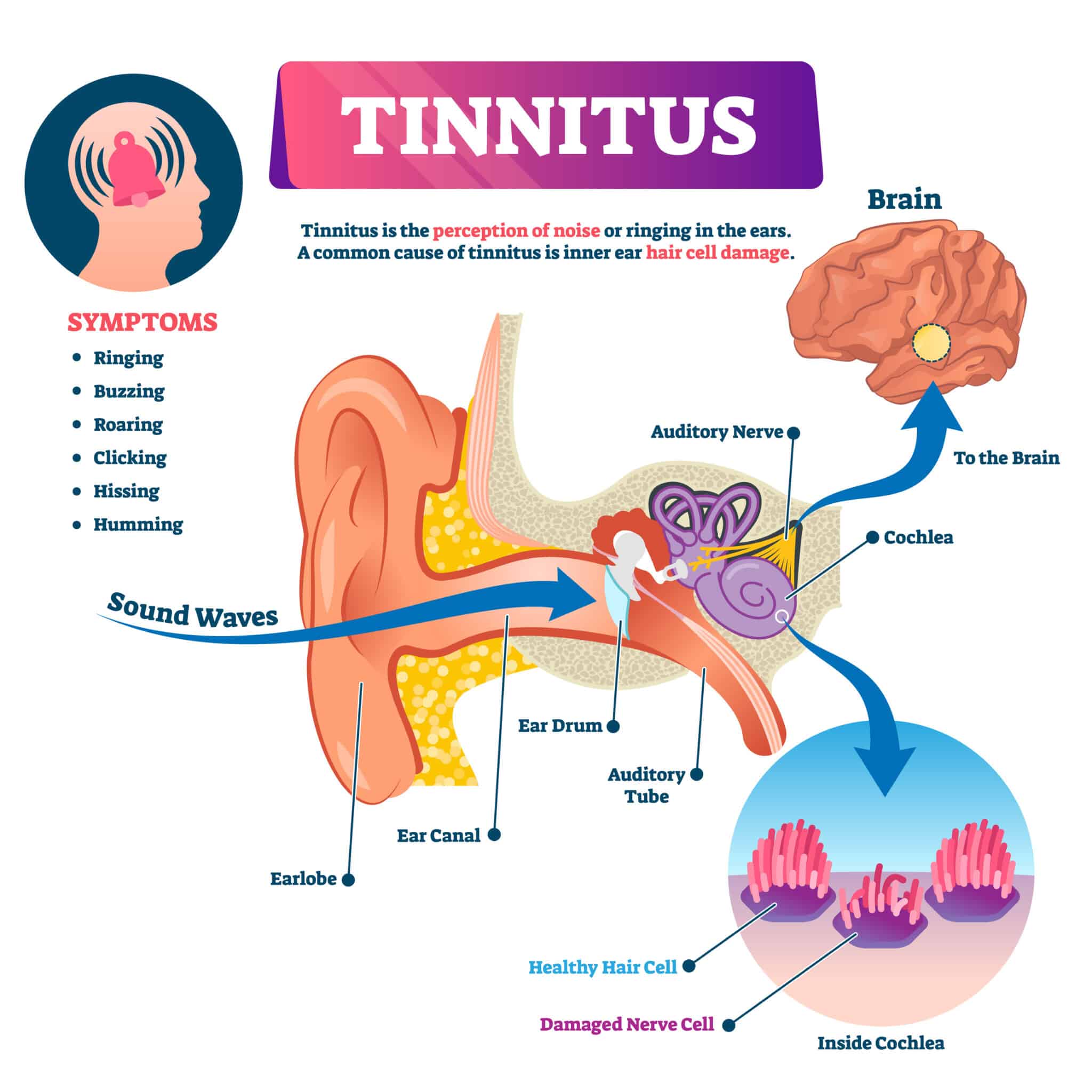 latest research on tinnitus 2021